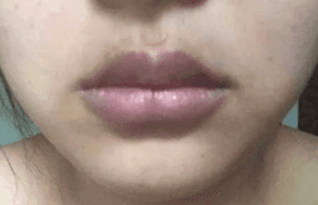 嘴唇发紫是心脏问题吗？这些征兆要小心