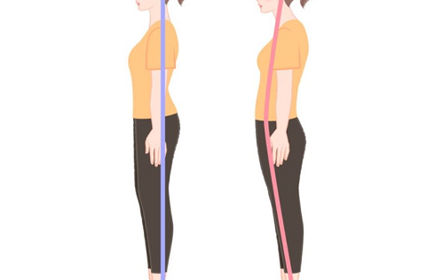 女性骨盆歪斜会引发哪些问题？